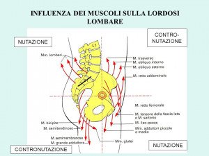 IPERLORDOSI LOMBARE NAPOLI