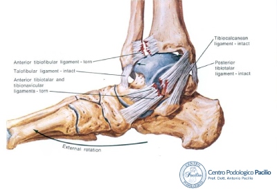 lesioni-legamentose